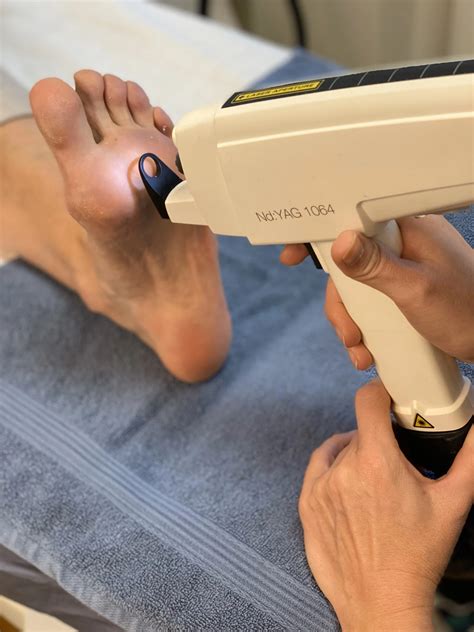 vorter laserbehandling