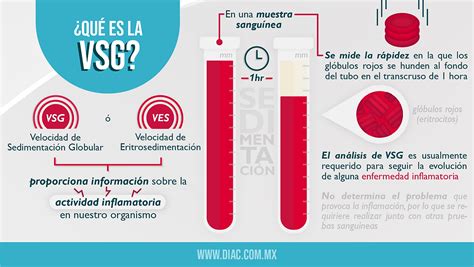 Vsg Que Es