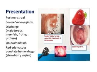 vulvovaginitis toddler bleeding