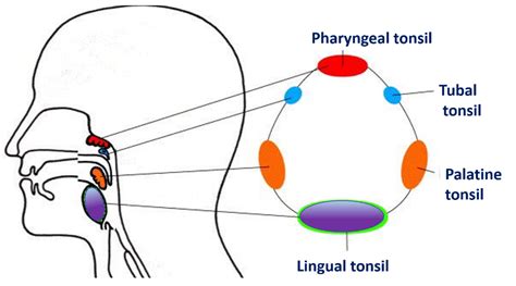 Waldeyer's Tonsillar Ring