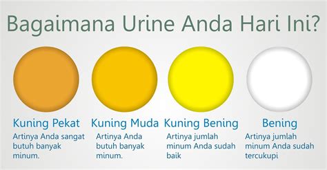 warna urine