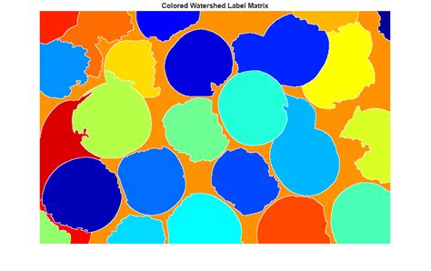 Watershed Segmentation Matlab Code
