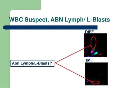 Wbc Ip Message Blasts Abn Lympho