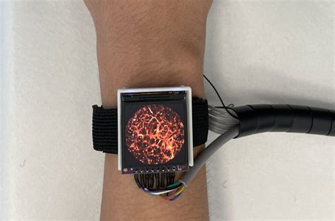 Wearable Tech Captures Real Time Hemodynamics On The Blood Flow Science - Blood Flow Science