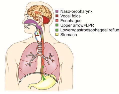 wegweiser reflux