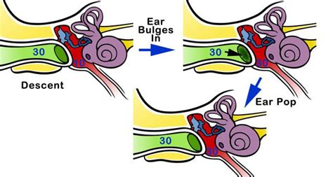 weird noise in ear when moving head