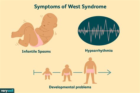 West Sendromu Nedir