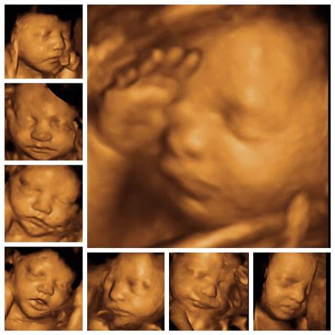 What Are 3d And 4d Ultrasound Scans Babycentre 2d And 3d Shape - 2d And 3d Shape