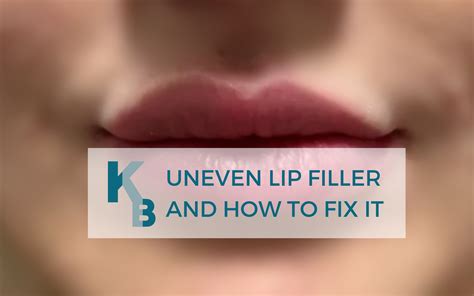 what causes uneven lips