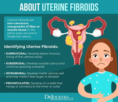 What Causes Uterine Fibroids And Polyps
