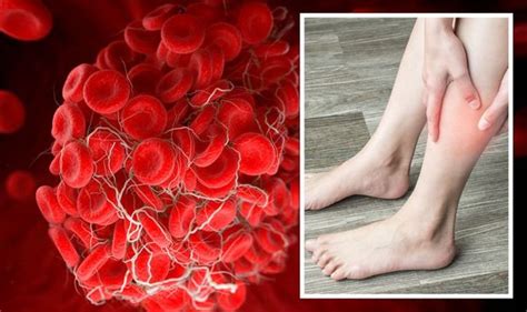 what does a blood clot look like pictures