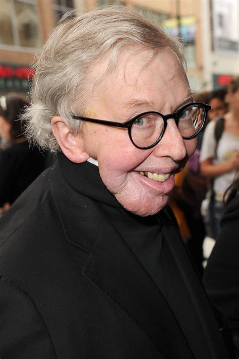 what happened to roger ebert face