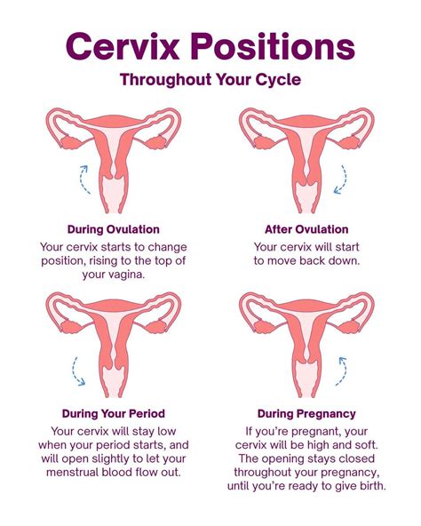 what happens when your cervix is open