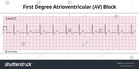 What Is A First Degree Relative