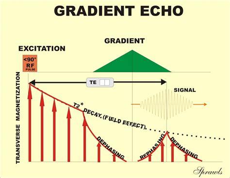 What Is A Gradient Echo Sequence