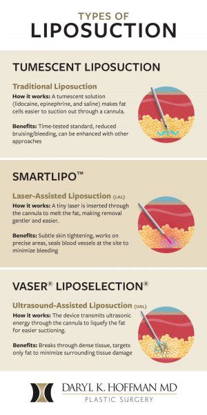 what is liposelection