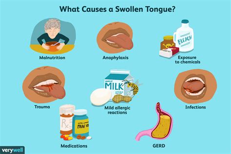 what makes your mouth swell up every