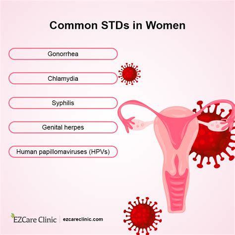 What S Std Stand For