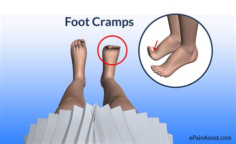 what to do when foot is cramping