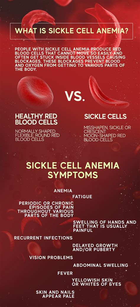 Read What Causes Sickle Cell Anemia Yahoo Answers 