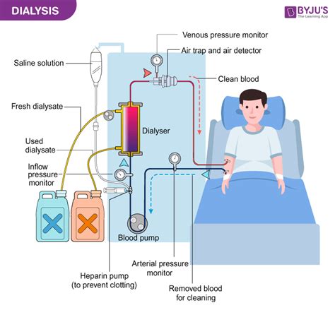 when dialysis should be done