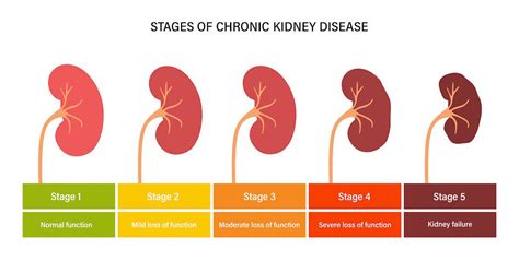 when is kidney failure fatal