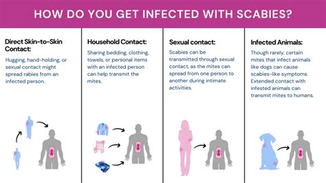 when is scabies not contagious