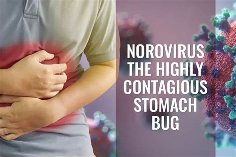 when is vomiting bug contagious