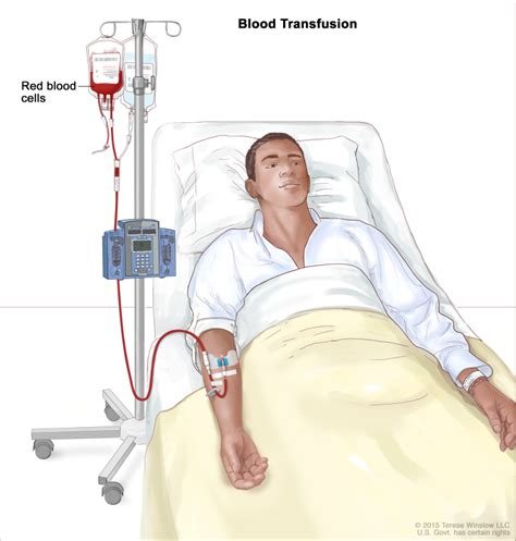 when should a blood transfusion be given