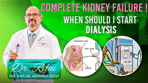when should dialysis be started