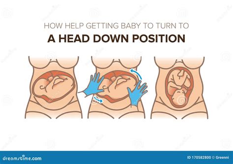 when should fetus turn head down