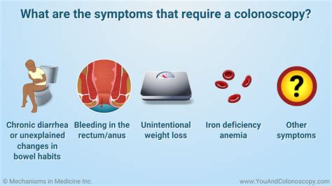 when should get a colonoscopy