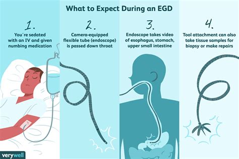 when should i get an endoscopy