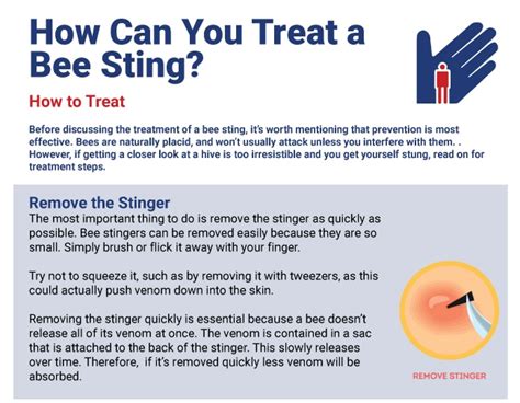 When Treating Bites Stings You Should Use