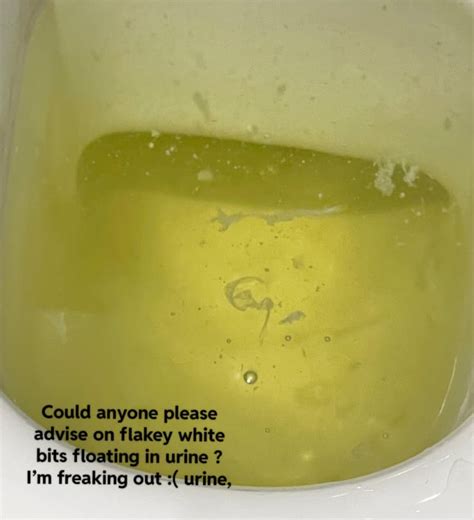 white mucus in pee