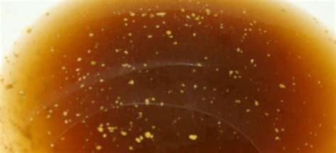 white specks in human stool