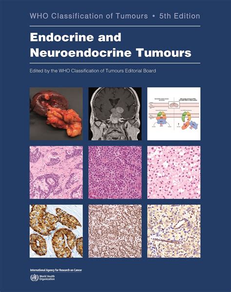 who classification of endocrine tumours
