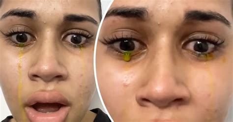 Why Am I Crying Yellow