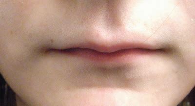 why do i have very small lips like