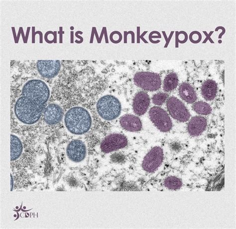 why is monkeypox mostly found in gay men