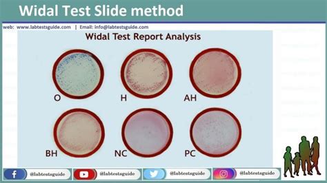 Widal Slide Method