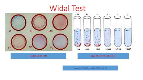 Widal Test Ppt