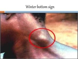 Winter Bottom Sign