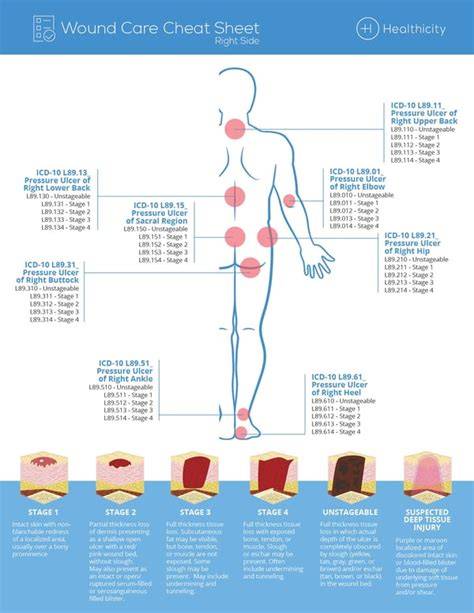 Wound Care Coding Cheat Sheet