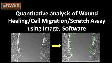 wound healing assay quantification image j software