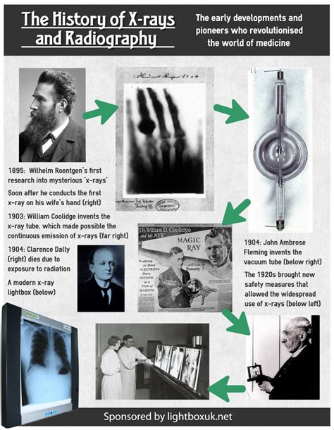 X Ray Definition History Amp Facts Britannica Rays Science - Rays Science