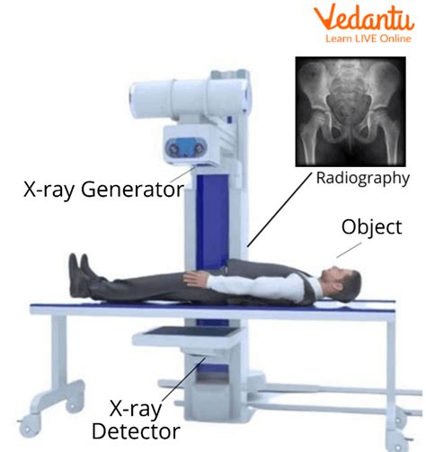 X Ray Machine Working