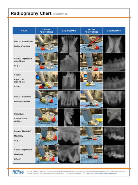 x ray positioning chart