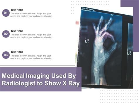 X Ray Ppt