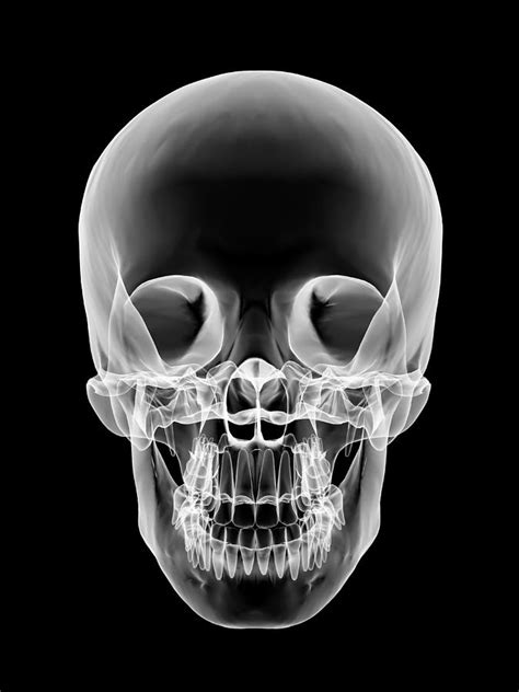 Xray Skull Front